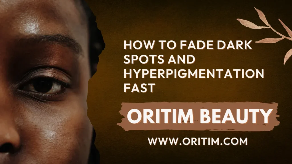 How to Fade Dark Spots and Hyperpigmentation Fast