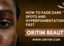 How to Fade Dark Spots and Hyperpigmentation Fast